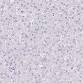 Anti-CTSE antibody produced in rabbit Prestige Antibodies® Powered by Atlas Antibodies, affinity isolated antibody, buffered aqueous glycerol solution
