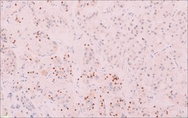 SF-1 (EP434) Rabbit Monoclonal Primary Antibody