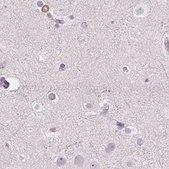 Anti-PRL antibody produced in rabbit Prestige Antibodies® Powered by Atlas Antibodies, affinity isolated antibody