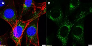 Anti-IL1R1 Antibody, clone 2J18 ZooMAb® Rabbit Monoclonal recombinant, expressed in HEK 293 cells