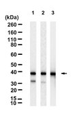 Anti-SCD Antibody, clone 2C2 ZooMAb® Rabbit Monoclonal recombinant, expressed in HEK 293 cells