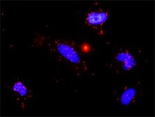 Monoclonal Anti-MMP9 antibody produced in mouse clone 2H4, purified immunoglobulin, buffered aqueous solution