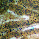 抗-磷酸-PPAR-γ (pSer112) 兔抗 affinity isolated antibody