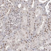 Anti-WRAP53 antibody produced in rabbit Prestige Antibodies® Powered by Atlas Antibodies, affinity isolated antibody, buffered aqueous glycerol solution