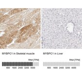 Anti-MYBPC1 antibody produced in rabbit Prestige Antibodies® Powered by Atlas Antibodies, affinity isolated antibody, buffered aqueous glycerol solution