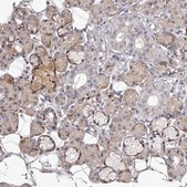 Anti-TNN antibody produced in rabbit Prestige Antibodies® Powered by Atlas Antibodies, affinity isolated antibody, buffered aqueous glycerol solution, ab2