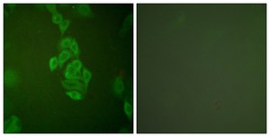 Anti-NSE antibody produced in rabbit affinity isolated antibody