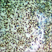 Anti-phospho-PP2A-α (pTyr307) antibody produced in rabbit affinity isolated antibody