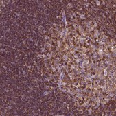 抗-CD45 兔抗 Prestige Antibodies® Powered by Atlas Antibodies, affinity isolated antibody, buffered aqueous glycerol solution