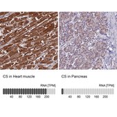 Anti-CS antibody produced in rabbit Prestige Antibodies® Powered by Atlas Antibodies, affinity isolated antibody, buffered aqueous glycerol solution