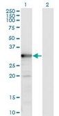 Monoclonal Anti-TYMS antibody produced in mouse clone 2B2, purified immunoglobulin, buffered aqueous solution