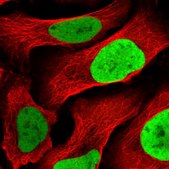 Anti-MCM4 antibody produced in rabbit Prestige Antibodies® Powered by Atlas Antibodies, affinity isolated antibody
