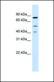 Anti-STAT3 antibody produced in rabbit affinity isolated antibody