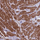 Anti-CKM antibody produced in rabbit Prestige Antibodies® Powered by Atlas Antibodies, affinity isolated antibody, buffered aqueous glycerol solution