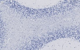 Anti-CNPase Antibody, clone 3N12 ZooMAb® Rabbit Monoclonal recombinant, expressed in HEK 293 cells