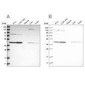 Anti-CNP antibody produced in rabbit Prestige Antibodies® Powered by Atlas Antibodies, affinity isolated antibody, buffered aqueous glycerol solution, Ab4