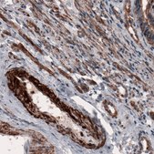Monoclonal Anti-ACTB antibody produced in mouse Prestige Antibodies® Powered by Atlas Antibodies, clone CL3868, purified immunoglobulin, buffered aqueous glycerol solution