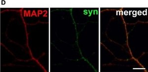 Anti-MAP2 Antibody, clone AP20 clone AP20, Chemicon®, from mouse