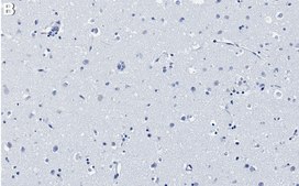 Anti-MCAM/CD146 Antibody, clone 1C21 ZooMAb® Rabbit Monoclonal recombinant, expressed in HEK 293 cells