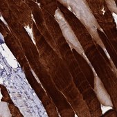 Anti-TNNT3 antibody produced in rabbit Prestige Antibodies® Powered by Atlas Antibodies, affinity isolated antibody, buffered aqueous glycerol solution