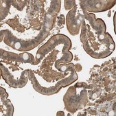 Anti-USP2 antibody produced in rabbit Ab1, Prestige Antibodies® Powered by Atlas Antibodies, affinity isolated antibody, buffered aqueous glycerol solution