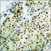 Anti-phospho-MEF2A (pThr312) antibody produced in rabbit affinity isolated antibody