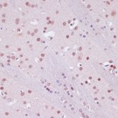 Anti- KDM1 antibody produced in rabbit
