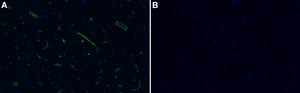 Anti-Laminin α2 80 kDa Antibody, clone 5H2 ZooMAb® Mouse Monoclonal recombinant, expressed in HEK 293 cells