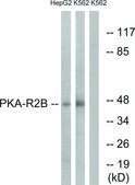 Anti-PKA-R2 β antibody produced in rabbit affinity isolated antibody