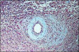 抗 成纤维细胞生长因子-碱性 (1-24) 兔抗 fractionated antiserum, lyophilized powder