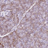 Anti-PDIA2 antibody produced in rabbit Prestige Antibodies® Powered by Atlas Antibodies, affinity isolated antibody, buffered aqueous glycerol solution
