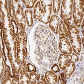 Anti-ATP5B antibody produced in rabbit Ab1, Prestige Antibodies® Powered by Atlas Antibodies, affinity isolated antibody, buffered aqueous glycerol solution
