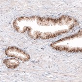Monoclonal Anti-GRN antibody produced in mouse Prestige Antibodies® Powered by Atlas Antibodies, clone CL5695, purified immunoglobulin, buffered aqueous glycerol solution