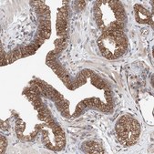 Anti-DNAH8 antibody produced in rabbit Prestige Antibodies® Powered by Atlas Antibodies, affinity isolated antibody, buffered aqueous glycerol solution, ab1