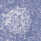 Anti-APOH antibody produced in rabbit Prestige Antibodies® Powered by Atlas Antibodies, affinity isolated antibody, buffered aqueous glycerol solution