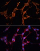 Anti-LPL antibody produced in rabbit