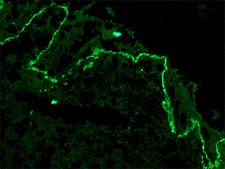 单克隆抗-胶原蛋白，VII 型 小鼠抗 clone LH7.2, ascites fluid