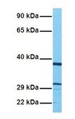 Anti-SLC25A4 affinity isolated antibody
