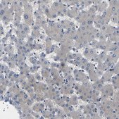 Anti-ERBB4 antibody produced in rabbit Prestige Antibodies® Powered by Atlas Antibodies, affinity isolated antibody, buffered aqueous glycerol solution
