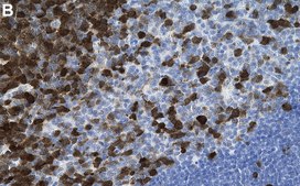 Anti-TYMS Antibody, clone 1E20 ZooMAb® Rabbit Monoclonal recombinant, expressed in HEK 293 cells