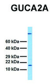 Anti-GUCA2A antibody produced in rabbit affinity isolated antibody