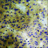 抗 磷酸化 PLK1 (pThr 210 ) 兔抗 affinity isolated antibody