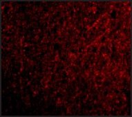 Anti-TSLP (ab2) antibody produced in rabbit affinity isolated antibody, buffered aqueous solution