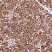 Anti-CLPS antibody produced in rabbit Prestige Antibodies® Powered by Atlas Antibodies, affinity isolated antibody, buffered aqueous glycerol solution