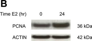 Monoclonal Anti-Actin antibody produced in mouse clone AC-40, ascites fluid