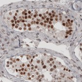 Monoclonal Anti-DAXX antibody produced in mouse Prestige Antibodies® Powered by Atlas Antibodies, clone CL3580, purified immunoglobulin, buffered aqueous glycerol solution