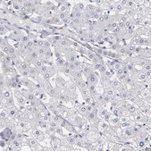 Anti-MGAM antibody produced in rabbit Prestige Antibodies® Powered by Atlas Antibodies, affinity isolated antibody, buffered aqueous glycerol solution