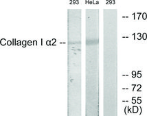 Anti-Collagen I α2 antibody produced in rabbit affinity isolated antibody