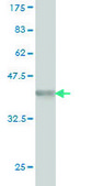 Monoclonal Anti-PARP1 antibody produced in mouse clone 3G4, purified immunoglobulin, buffered aqueous solution