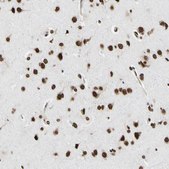 Anti-HNRNPK antibody produced in rabbit Prestige Antibodies® Powered by Atlas Antibodies, affinity isolated antibody, buffered aqueous glycerol solution